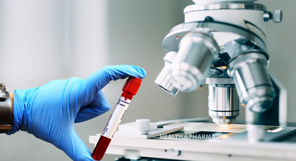 Μια απλή και πολλά υποσχόμενη εξέταση αίματος, που δημιούργησε επιστημονική ομάδα του Χάρβαρντ, είναι σε θέση να διαγνώσει με μεγάλη ακρίβεια πάνω από 20 τύπους καρκίνου, όπως αποδεικνύει νέα μελέτη.