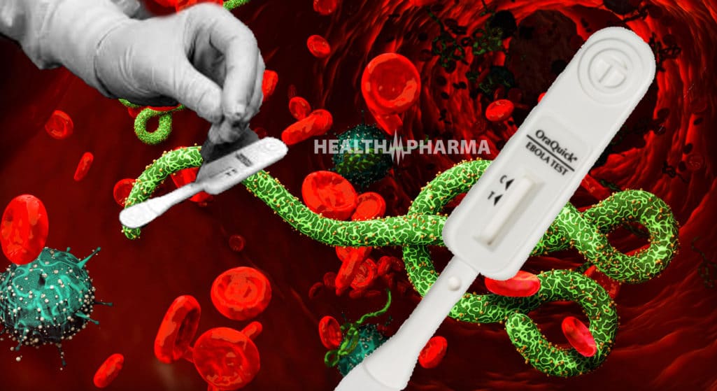 Τον πρώτο in vitro διαγνωστικό έλεγχο «ανάγνωσης» λοιμώξεων -σε μόλις 30 λεπτά- για τον ιό του Έμπολα ενέκρινε η Αμερικανική Υπηρεσία Τροφίμων και Φαρμάκων (FDA), από την OraSure Technologies.