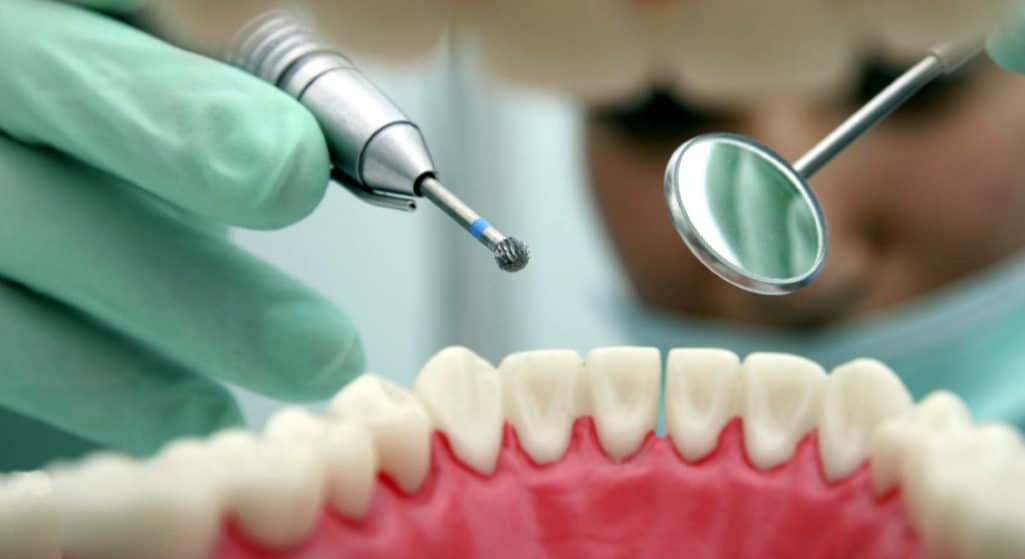 Τη σταδιακή μείωση του αριθμού των εμφράξεων οδοντιατρικού αμαλγάματος (δηλαδή τα μαύρα σφραγίσματα) μέχρι το 2030, προβλέπει κανονισμός της ΕΕ.