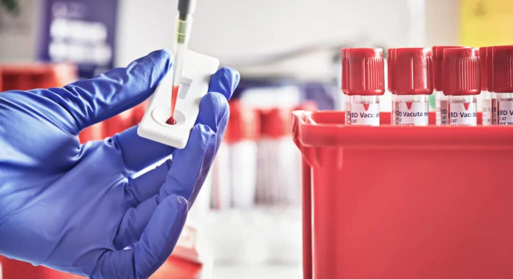 Προσωρινά χειρόφρενο στα δημόσια νοσοκομεία τραβάει το Εθνικό Κέντρο Αιμοδοσίας (ΕΚΕΑ) ζητώντας να μην στέλνουν άλλα μοριακά τεστ για έλεγχο καθώς δηλώνει αδυναμία εκτέλεσης ελέγχου του Covid-19