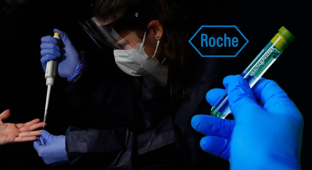 Ένα νέο τεστ αντιγόνων θα κυκλοφορήσει η Roche, το οποίο μπορεί να γίνεται σε μεγάλο όγκο, για τη διάγνωση του κορωνοϊού.